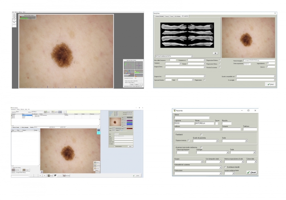 Facilità, misurazioni, qualità e compatibilità - Software DDAX3 e Video Dermatoscopi HD Dell'Eva-Burroni